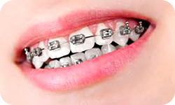 Orthodontics 1