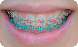 Orthodontics 2