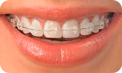 Orthodontics 3