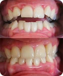 Periodontal 2