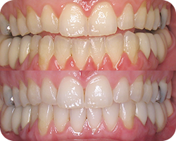 Periodontal 3