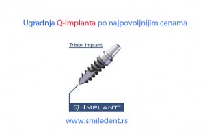 Q implant promocija